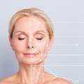 Skin Tightening with Microcurrent at medspa810